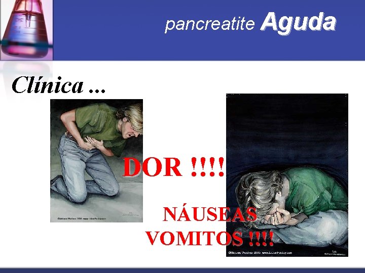 pancreatite Aguda Clínica. . . DOR !!!! NÁUSEAS VOMITOS !!!! 