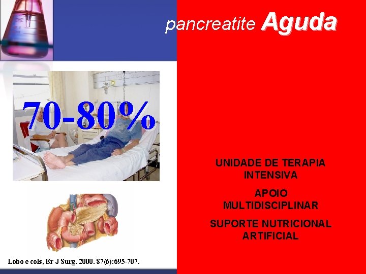 pancreatite Aguda 70 -80% 20 -30% UNIDADE DE TERAPIA INTENSIVA APOIO MULTIDISCIPLINAR SUPORTE NUTRICIONAL