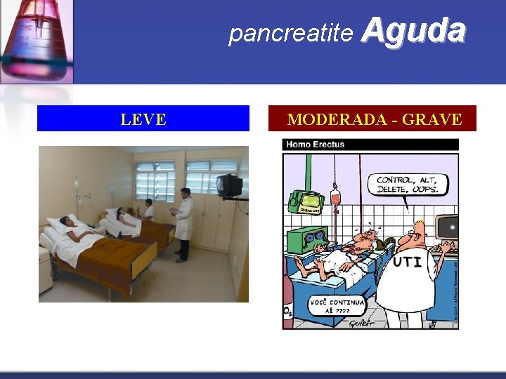 pancreatite Aguda LEVE MODERADA - GRAVE 