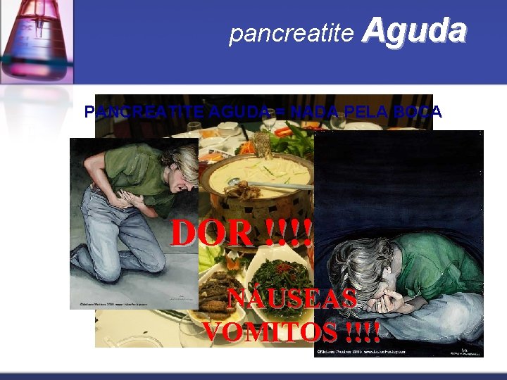 pancreatite Aguda PANCREATITE AGUDA = NADA PELA BOCA DOR !!!! NÁUSEAS VOMITOS !!!! 