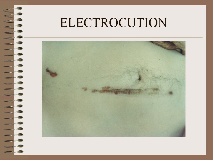ELECTROCUTION 