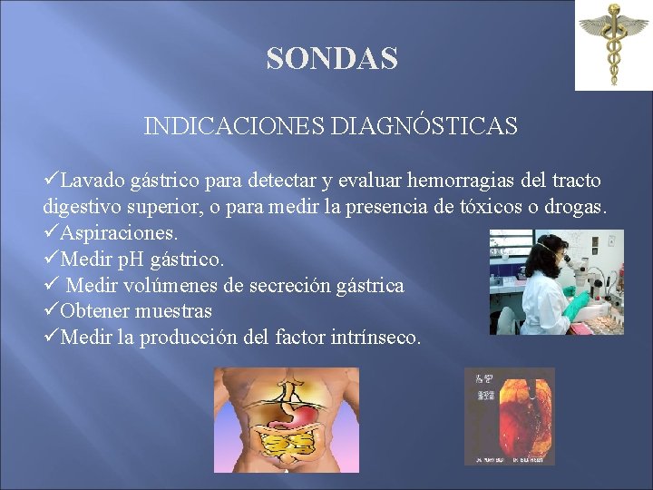 SONDAS INDICACIONES DIAGNÓSTICAS üLavado gástrico para detectar y evaluar hemorragias del tracto digestivo superior, SONDAS INDICACIONES DIAGNÓSTICAS üLavado gástrico para detectar y evaluar hemorragias del tracto digestivo superior,