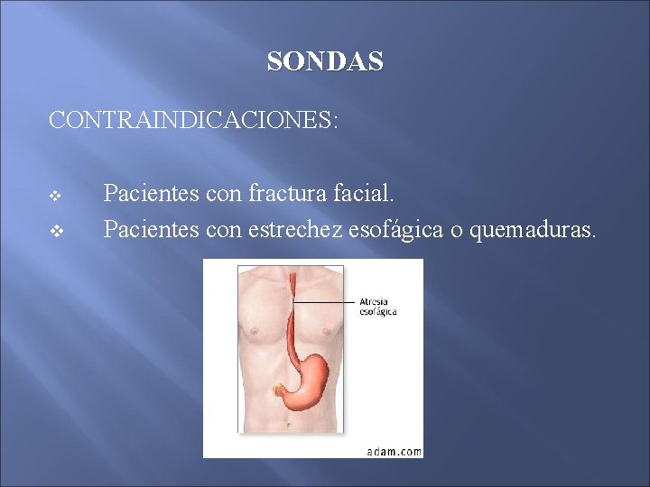 SONDAS CONTRAINDICACIONES: v v Pacientes con fractura facial. Pacientes con estrechez esofágica o quemaduras. SONDAS CONTRAINDICACIONES: v v Pacientes con fractura facial. Pacientes con estrechez esofágica o quemaduras.