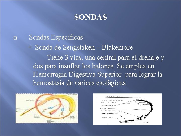 SONDAS Sondas Específicas: Sonda de Sengstaken – Blakemore Tiene 3 vías, una central para SONDAS Sondas Específicas: Sonda de Sengstaken – Blakemore Tiene 3 vías, una central para
