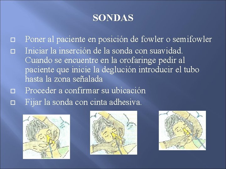 SONDAS Poner al paciente en posición de fowler o semifowler Iniciar la inserción de SONDAS Poner al paciente en posición de fowler o semifowler Iniciar la inserción de