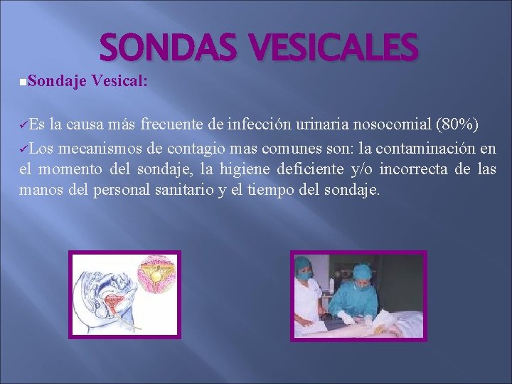 n. Sondaje üEs SONDAS VESICALES Vesical: la causa más frecuente de infección urinaria nosocomial n. Sondaje üEs SONDAS VESICALES Vesical: la causa más frecuente de infección urinaria nosocomial