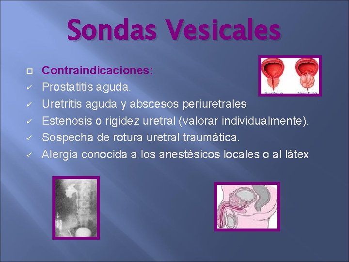 Sondas Vesicales ü ü ü Contraindicaciones: Prostatitis aguda. Uretritis aguda y abscesos periuretrales Estenosis Sondas Vesicales ü ü ü Contraindicaciones: Prostatitis aguda. Uretritis aguda y abscesos periuretrales Estenosis