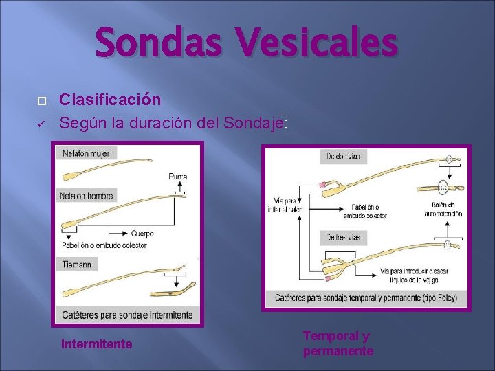 Sondas Vesicales ü Clasificación Según la duración del Sondaje: Intermitente Temporal y permanente Sondas Vesicales ü Clasificación Según la duración del Sondaje: Intermitente Temporal y permanente