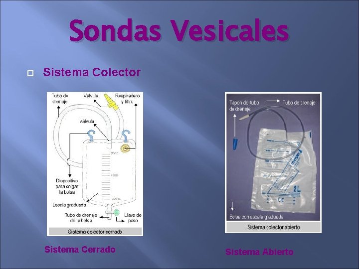 Sondas Vesicales Sistema Colector Sistema Cerrado Sistema Abierto Sondas Vesicales Sistema Colector Sistema Cerrado Sistema Abierto