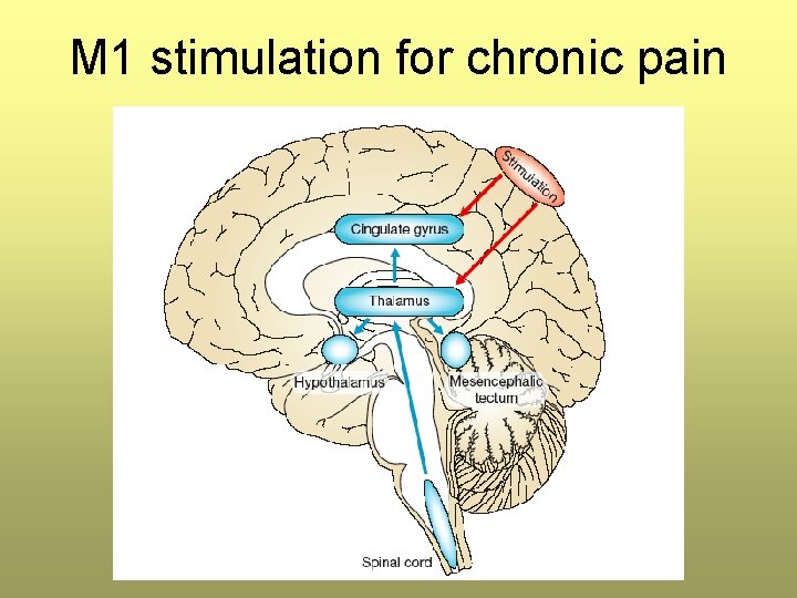 M 1 stimulation for chronic pain M 1 stimulation for chronic pain