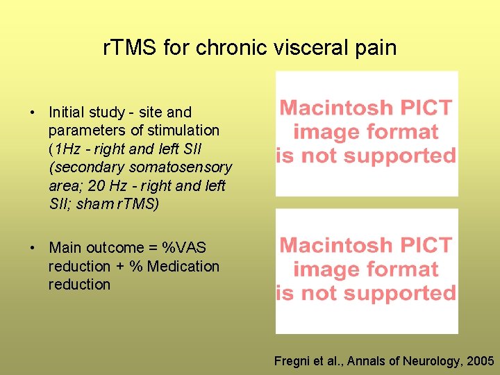 r. TMS for chronic visceral pain • Initial study - site and parameters of r. TMS for chronic visceral pain • Initial study - site and parameters of