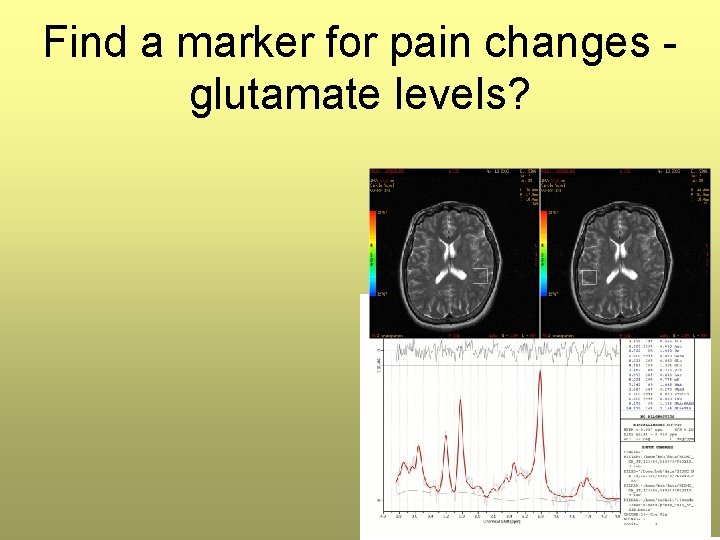 Find a marker for pain changes glutamate levels? Find a marker for pain changes glutamate levels?