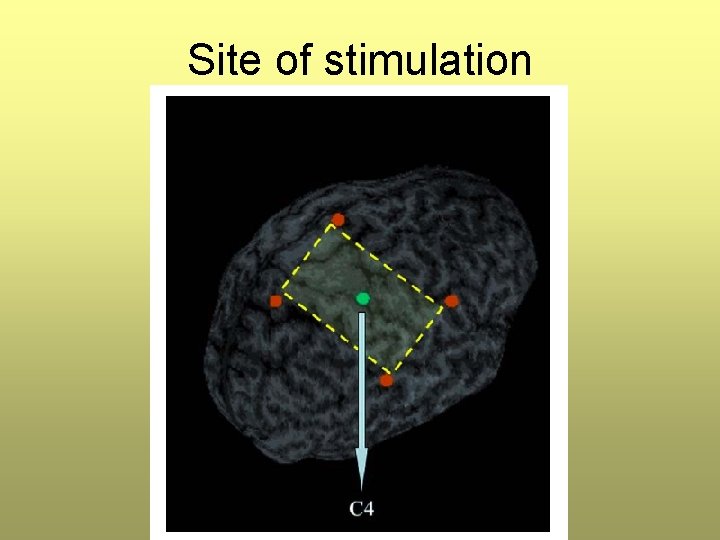Site of stimulation Site of stimulation