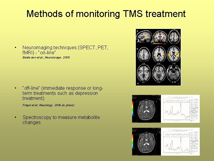 Methods of monitoring TMS treatment • Neuroimaging techniques (SPECT, PET, f. MRI) - “on-line” Methods of monitoring TMS treatment • Neuroimaging techniques (SPECT, PET, f. MRI) - “on-line”
