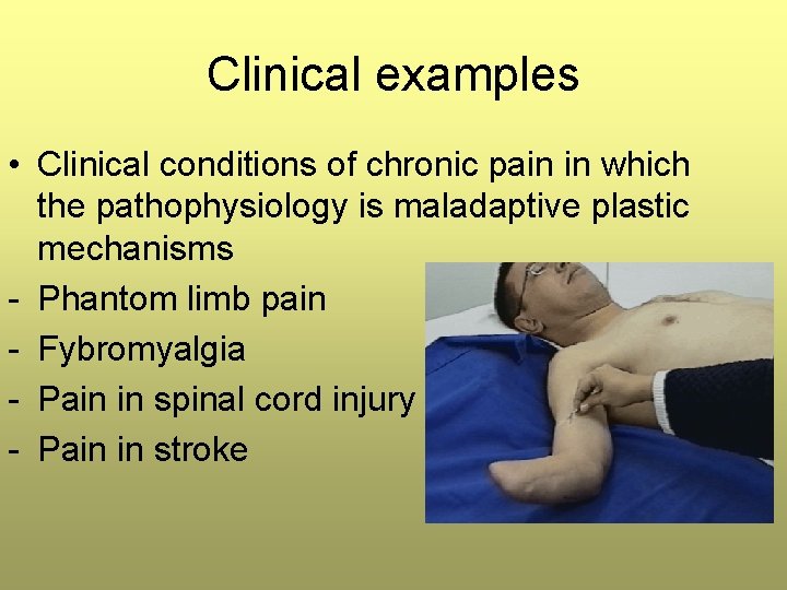 Clinical examples • Clinical conditions of chronic pain in which the pathophysiology is maladaptive Clinical examples • Clinical conditions of chronic pain in which the pathophysiology is maladaptive