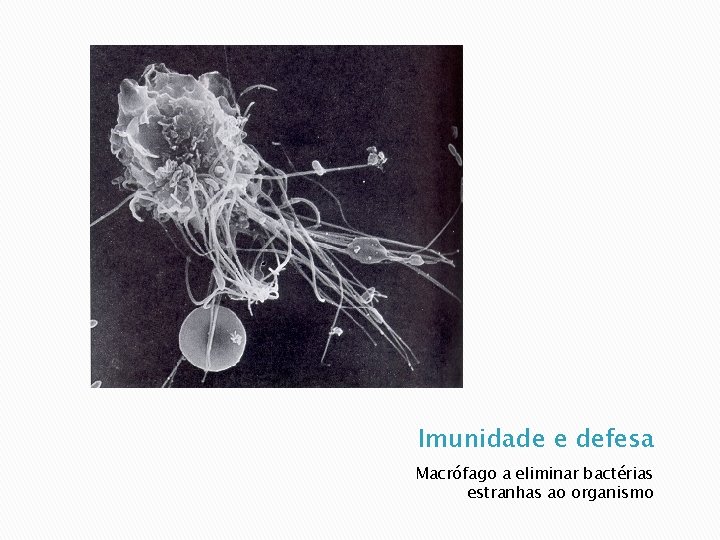 Imunidade e defesa Macrófago a eliminar bactérias estranhas ao organismo 