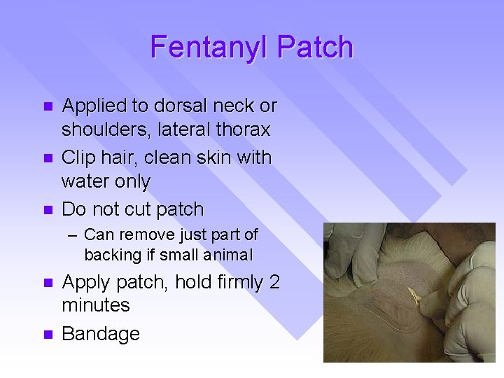 Fentanyl Patch n n n Applied to dorsal neck or shoulders, lateral thorax Clip