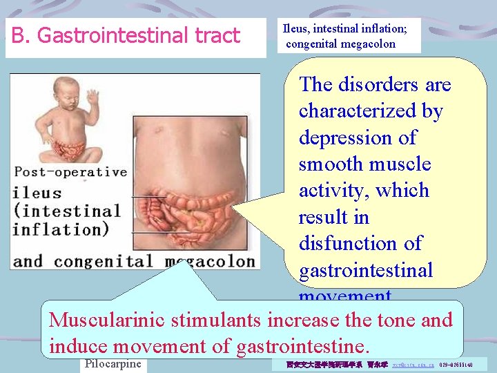 B. Gastrointestinal tract Ileus, intestinal inflation; congenital megacolon The disorders are characterized by depression