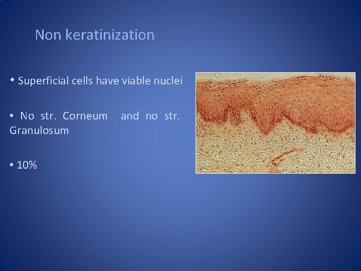 Non keratinization • Superficial cells have viable nuclei • No str. Corneum Granulosum •