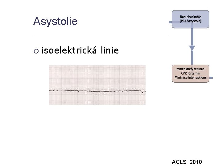 Asystolie isoelektrická linie ACLS 2010 