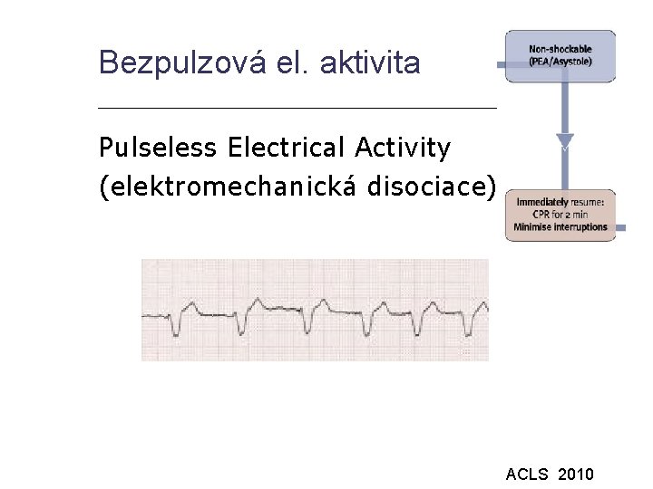 Bezpulzová el. aktivita Pulseless Electrical Activity (elektromechanická disociace) ACLS 2010 