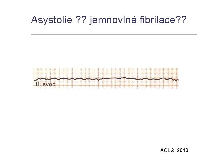 Asystolie ? ? jemnovlná fibrilace? ? ACLS 2010 