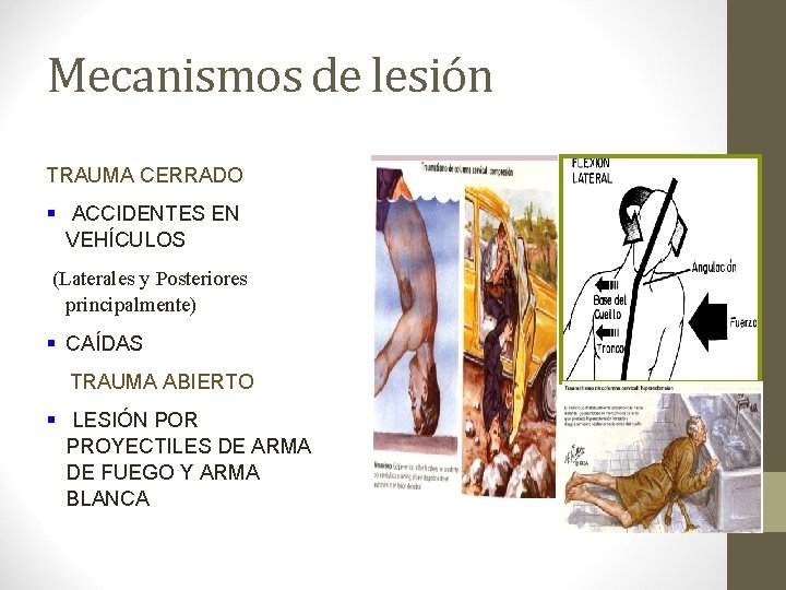 Mecanismos de lesión TRAUMA CERRADO § ACCIDENTES EN VEHÍCULOS (Laterales y Posteriores principalmente) §