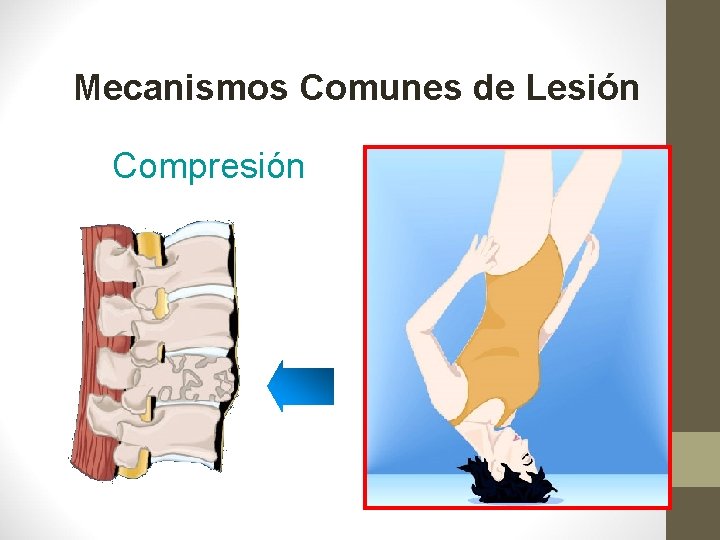 Mecanismos Comunes de Lesión Compresión 