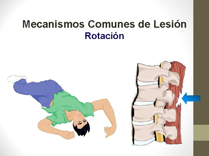 Mecanismos Comunes de Lesión Rotación 