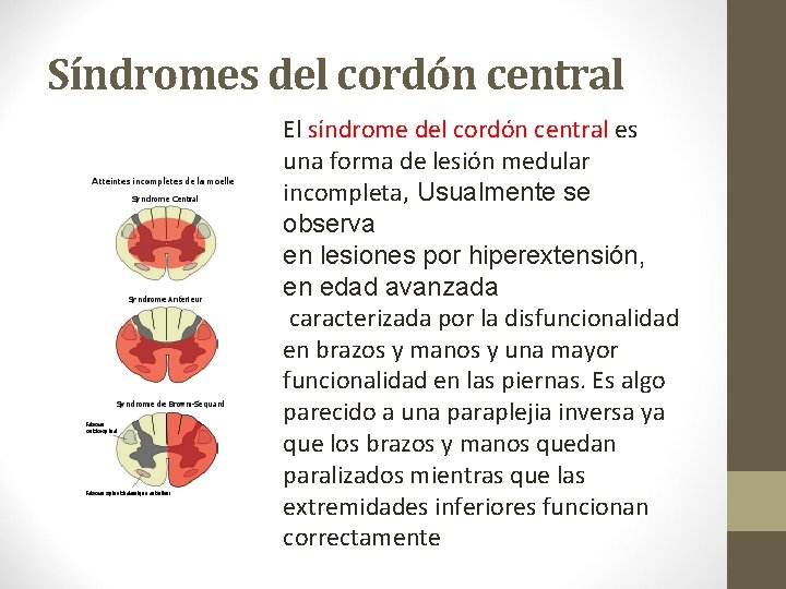 Síndromes del cordón central El síndrome del cordón central es una forma de lesión