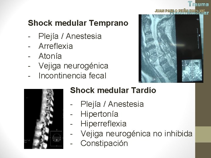 Trauma JUAN PABLO PEÑA DIAZ, MD Raqui Medular Shock medular Temprano - Plejía /