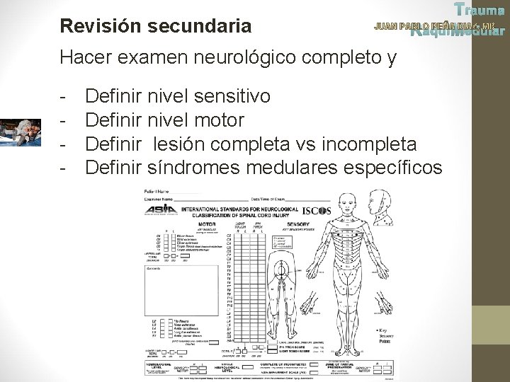 Revisión secundaria Trauma JUAN PABLO PEÑA DIAZ, MD Raqui Medular Hacer examen neurológico completo