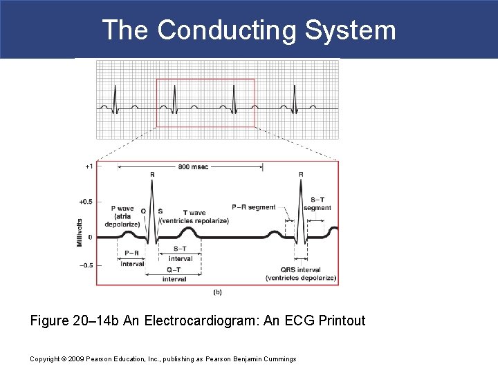 The Conducting System Figure 20– 14 b An Electrocardiogram: An ECG Printout Copyright ©