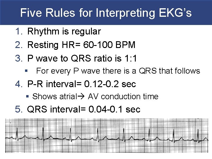 Five Rules for Interpreting EKG’s 1. Rhythm is regular 2. Resting HR= 60 -100