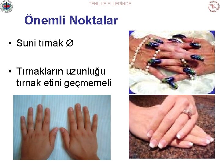 TEHLİKE ELLERİNDE Önemli Noktalar • Suni tırnak Ø • Tırnakların uzunluğu tırnak etini geçmemeli