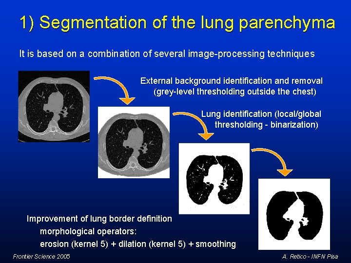 1) Segmentation of the lung parenchyma It is based on a combination of several 1) Segmentation of the lung parenchyma It is based on a combination of several