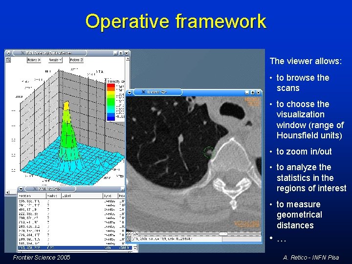 Operative framework The viewer allows: • to browse the scans • to choose the Operative framework The viewer allows: • to browse the scans • to choose the