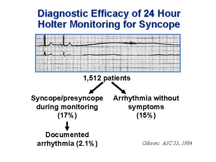 Diagnostic Efficacy of 24 Hour Holter Monitoring for Syncope 1, 512 patients Syncope/presyncope during