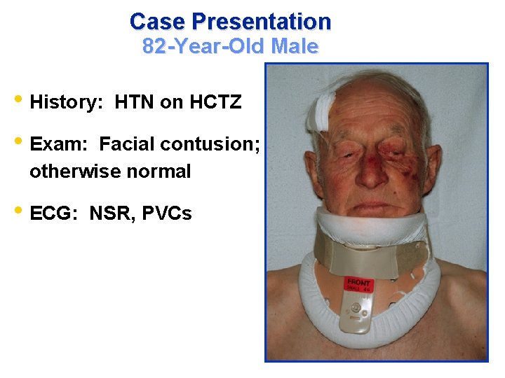 Case Presentation 82 -Year-Old Male • History: HTN on HCTZ • Exam: Facial contusion;