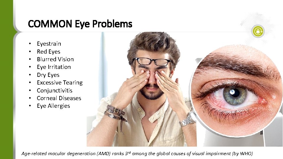 COMMON Eye Problems • • • Eyestrain Red Eyes Blurred Vision Eye Irritation Dry