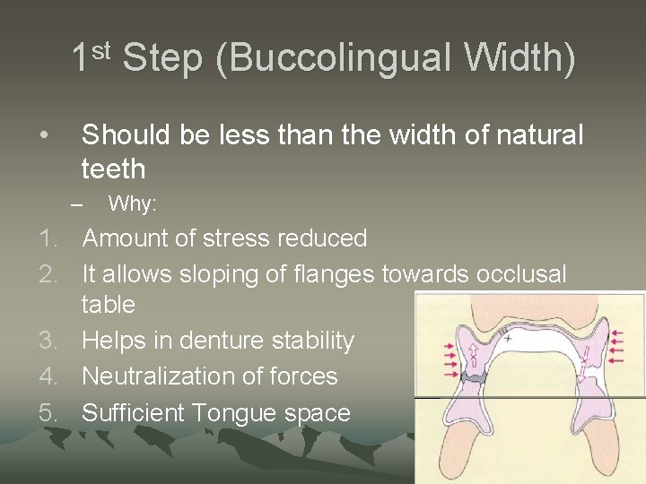 1 st Step (Buccolingual Width) • Should be less than the width of natural