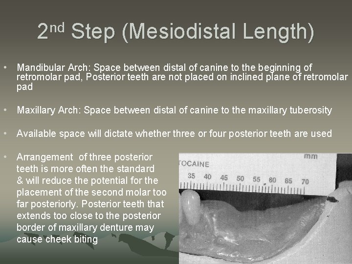 2 nd Step (Mesiodistal Length) • Mandibular Arch: Space between distal of canine to