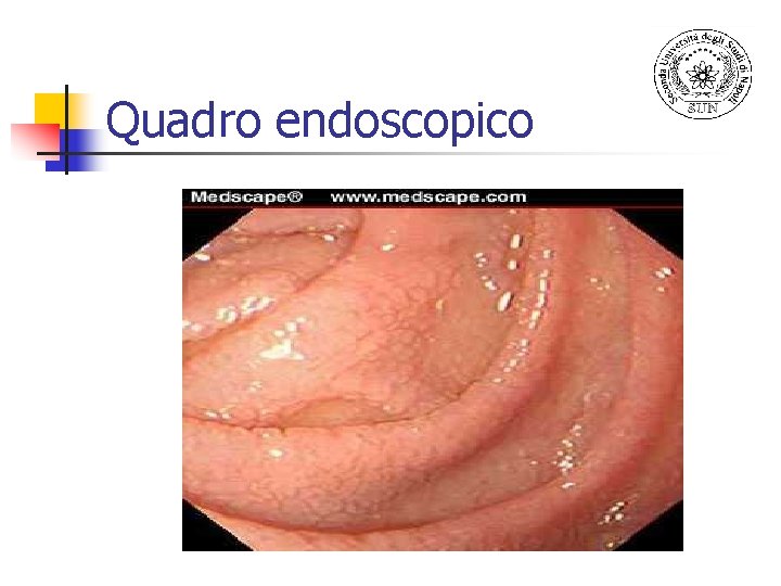 Quadro endoscopico 