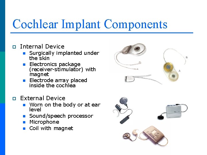 Cochlear Implant Components p Internal Device n n n p Surgically implanted under the