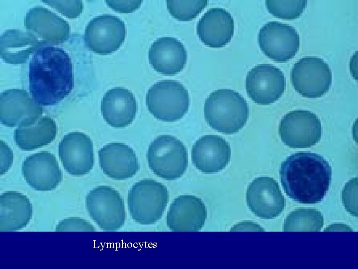 Lymphocytes 