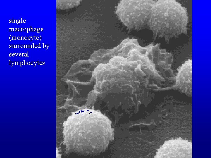 single macrophage (monocyte) surrounded by several lymphocytes 