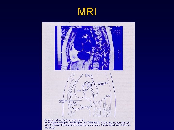 MRI 