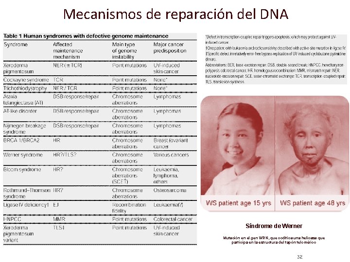 Mecanismos de reparación del DNA Síndrome de Werner Mutación en el gen WRN, que
