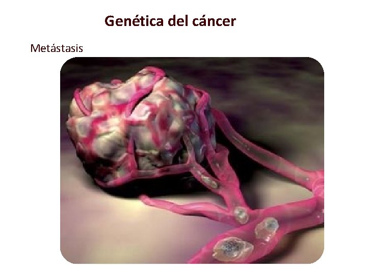 Genética del cáncer Metástasis 