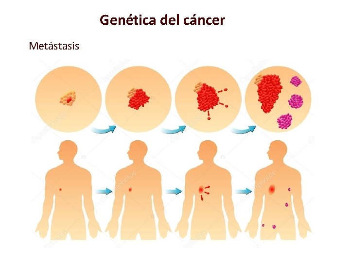 Genética del cáncer Metástasis 